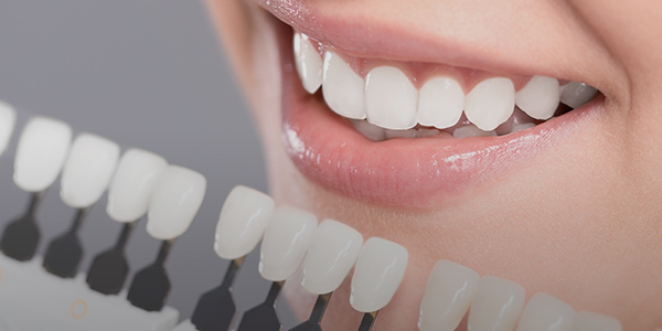 ホワイトニング